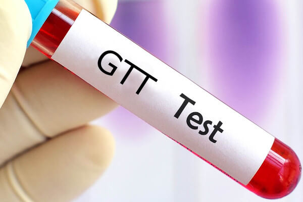 آزمایش GTT