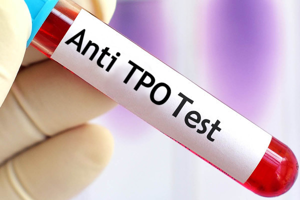 آزمایش anti tpo